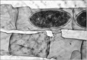 Spirogyra